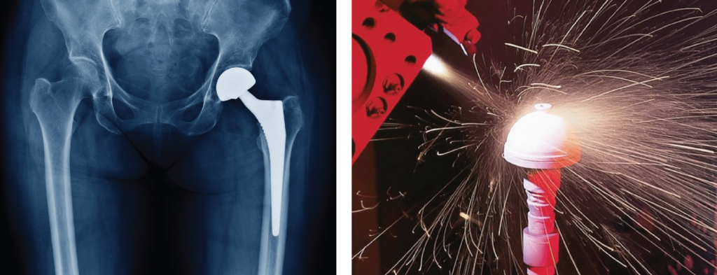 Medical devices and components requiring precision materials and biocompatible performance